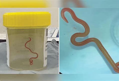  Rivulus: Parasitic Worm Lurking in the Shadows -  A Tiny Menace with a Big Appetite!